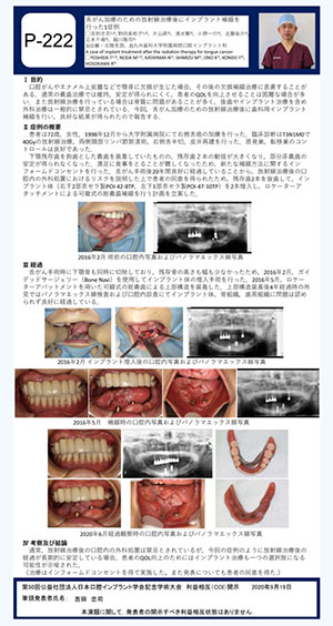 第50回　公益社団法人　日本口腔インプラント学会記念学術大会